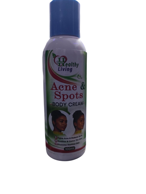 Health living Acne and Spot Body Cream(100ml)